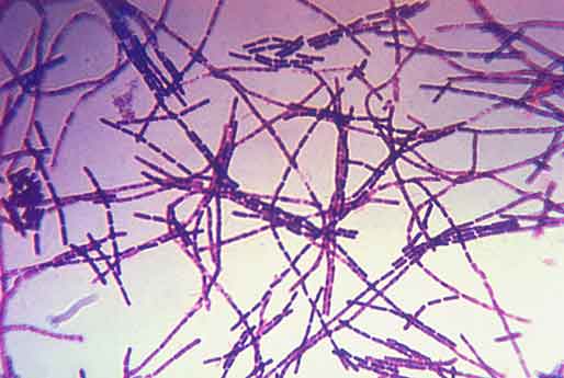Anthrax adalah penyakit infeksi bakteri yang disebabkan oleh bakteri Bacillus anthracis. Bakteri ini dapat menginfeksi hewan dan manusia. Anthrax dapat ditularkan melalui kontak dengan hewan yang terinfeksi, konsumsi daging hewan yang terinfeksi, atau menghirup udara yang terkontaminasi bakteri.