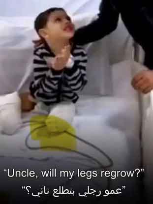 “Paman, apakah kakiku akan tumbuh kembali?” Kaki seorang anak diamputasi akibat pengeboman Israel di rumah mereka... Gambaran "kata-kata paling kasar"...